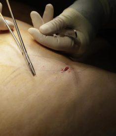 detail-doctor-suturing-surgery